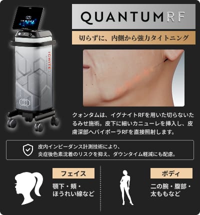 クォンタム（QUANTUM）とは