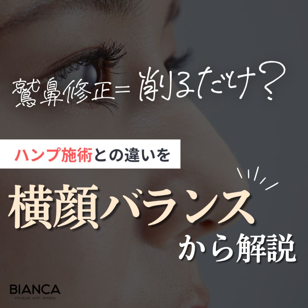 鷲鼻修正とハンプ切除の違いは？横顔バランスから考える鼻整形