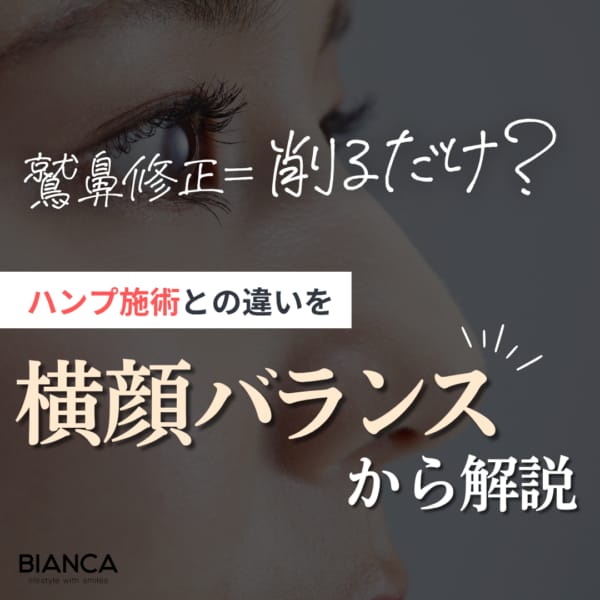 鷲鼻修正とハンプ切除の違いは？横顔バランスから考える鼻整形｜銀座・表参道にあるBIANCA CLINIC ビアンカクリニック｜美容外科・美容皮膚科・再生医療・美容婦人科・美容内科・医療アートメイク