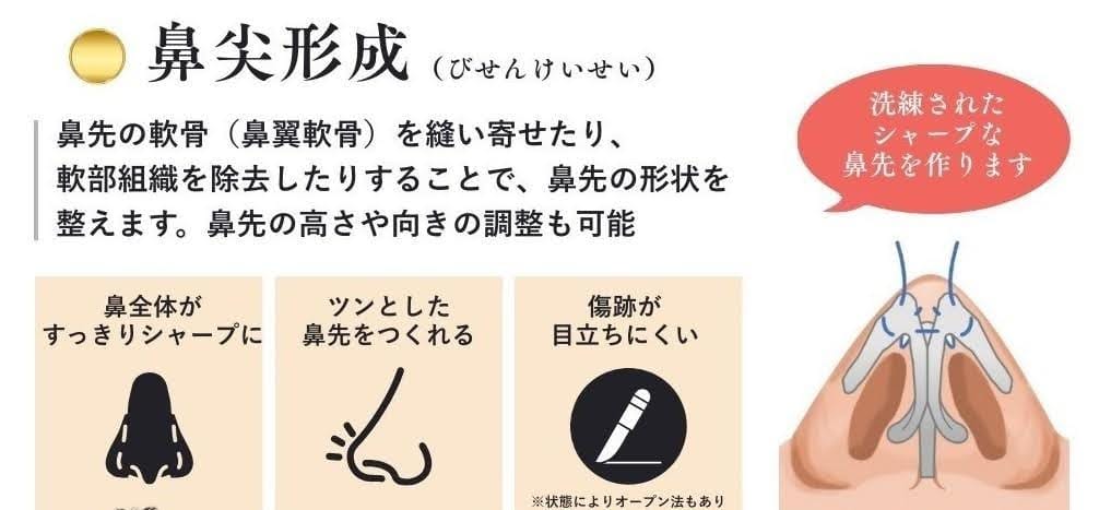鼻尖形成を説明する画像