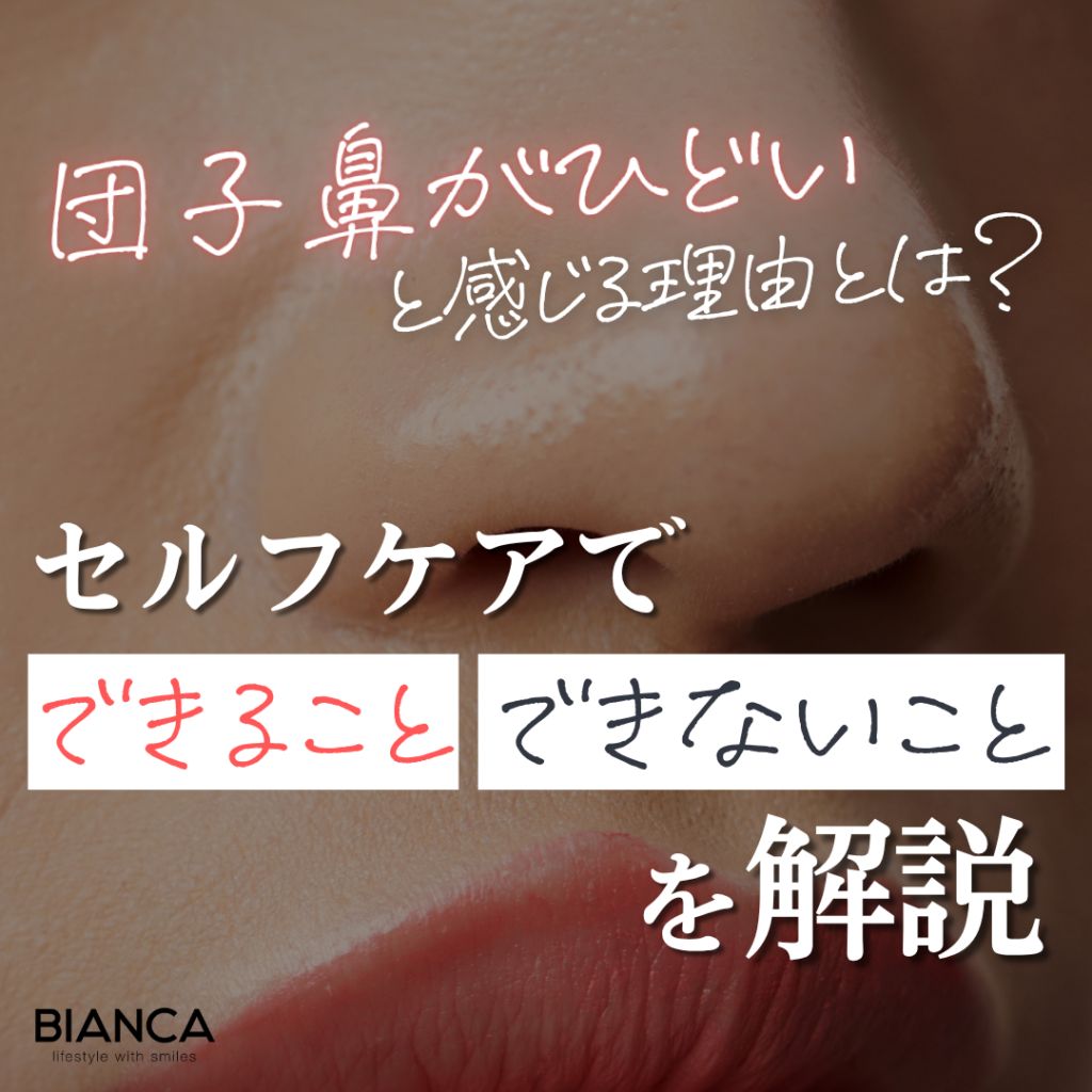 団子鼻がひどいと感じるのはなぜ？セルフケアで改善できる？美容医療との違いを形成外科医 八杉悠が解説