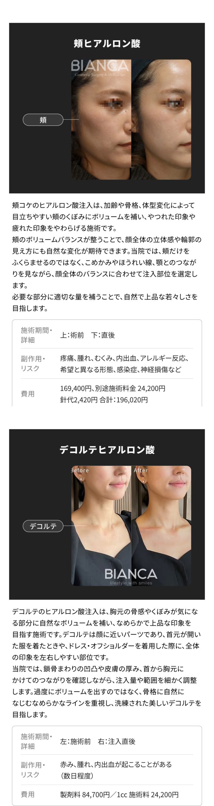 ヒアルロン酸注射 銀座・表参道にあるBIANCA CLINIC ビアンカ
