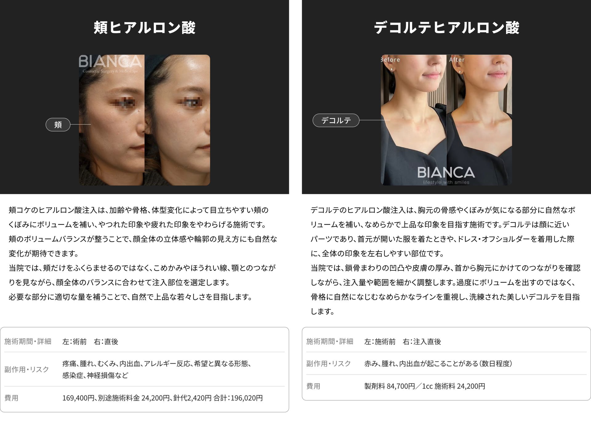 銀座・表参道のBIANCA CLINIC 頬ヒアルロン酸注射とデコルテヒアルロン酸注射の症例