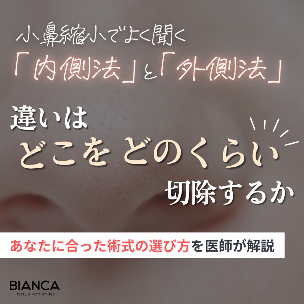 小鼻縮小の【内側法】は傷跡が目立たない？外側法との違いは？あなたに合った術式の選び方