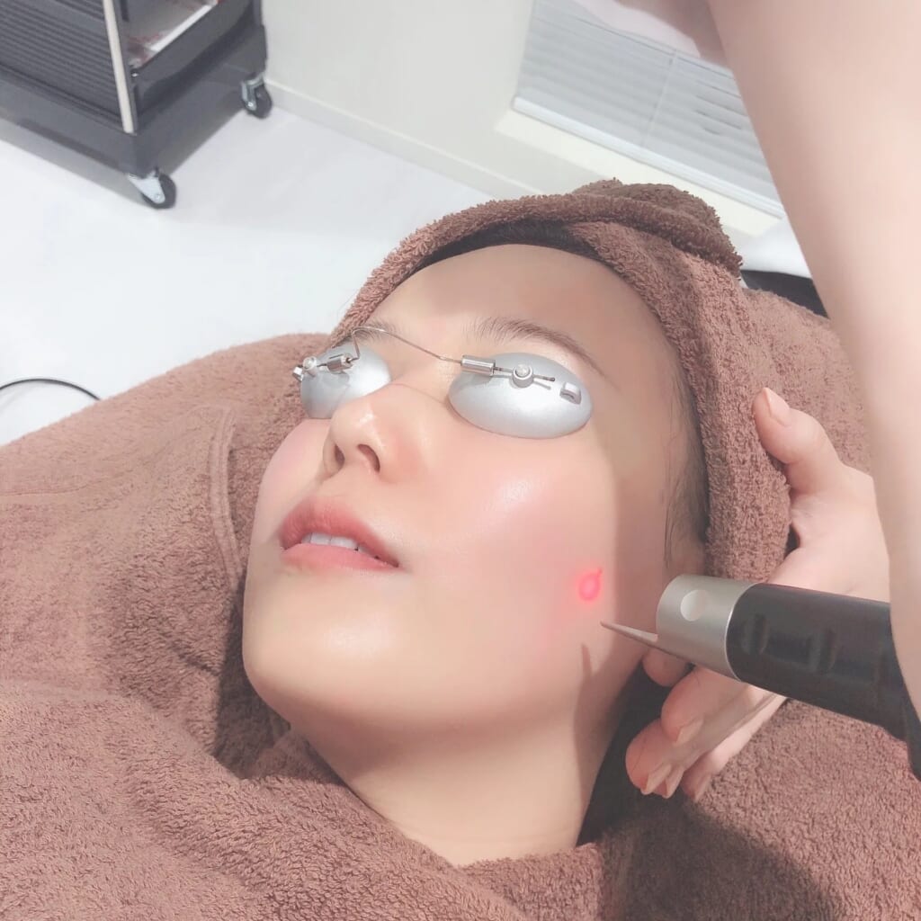 ピコスポット（Pico Spot） 銀座・表参道にあるBIANCA CLINIC ビアンカ