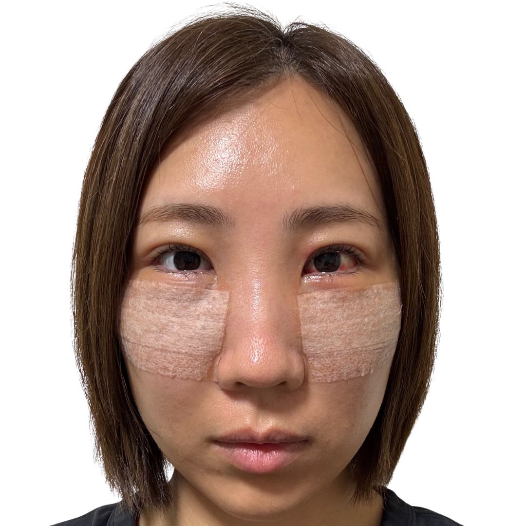 裏ハムラ法