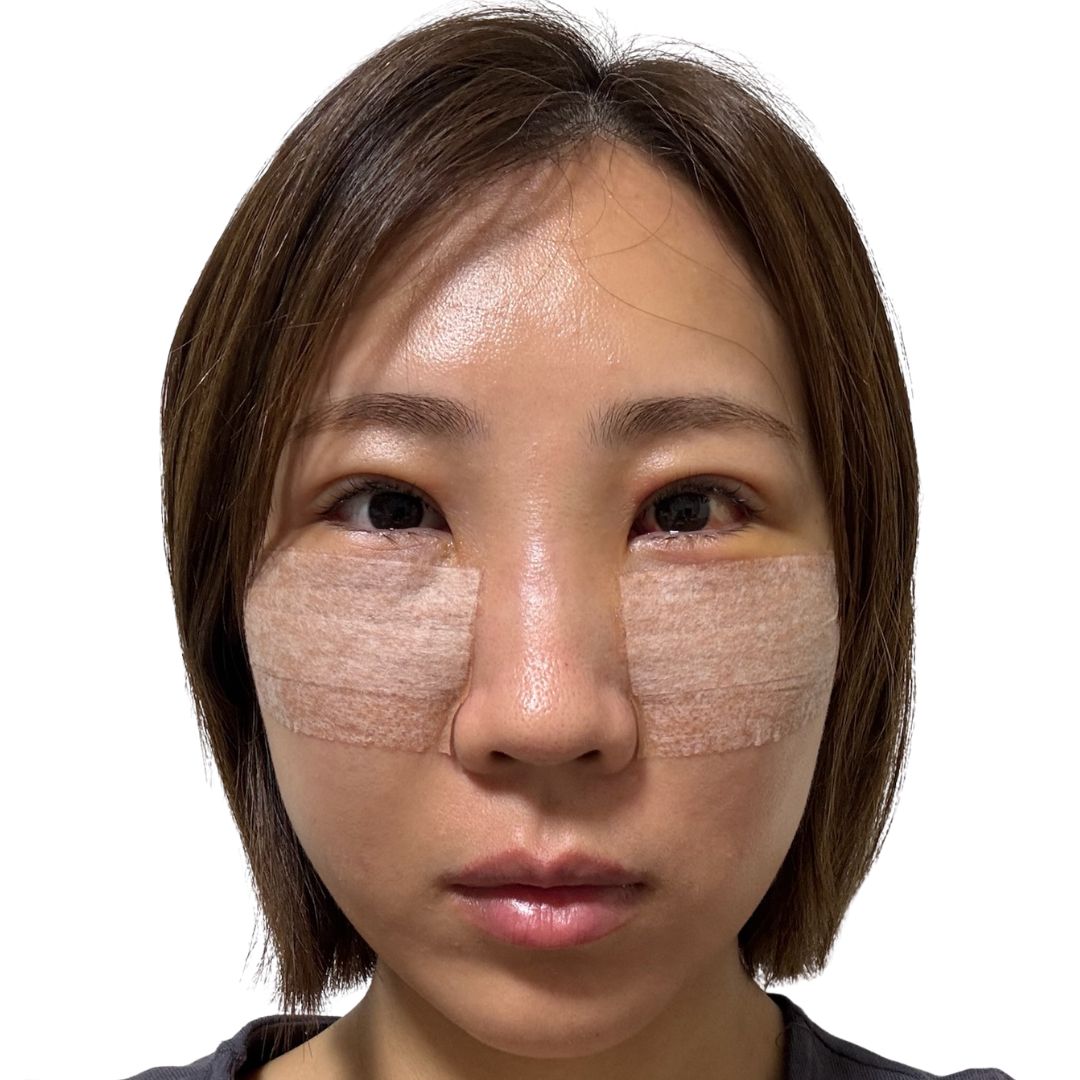 裏ハムラ法