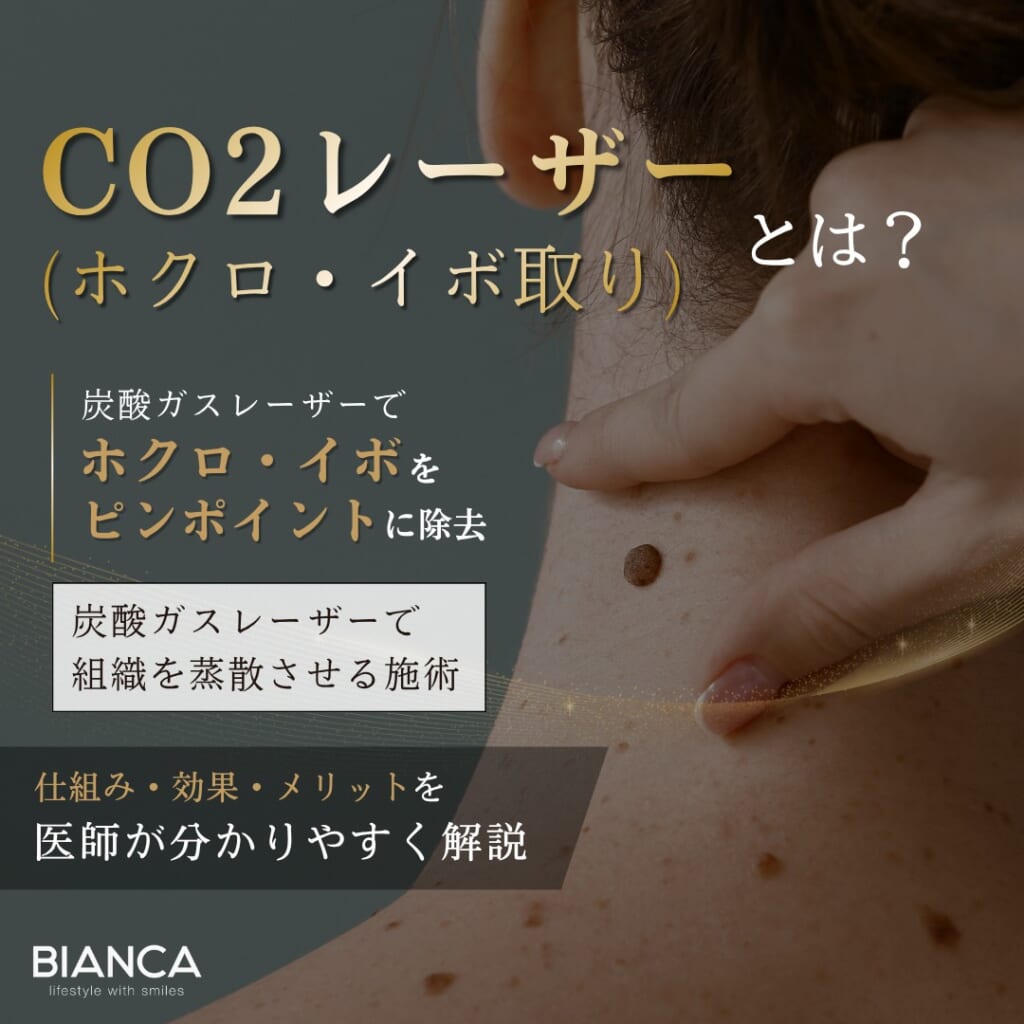 CO2レーザー（ホクロ・イボ取り）とは？期待できる効果・メリット・デメリットを分かりやすく解説