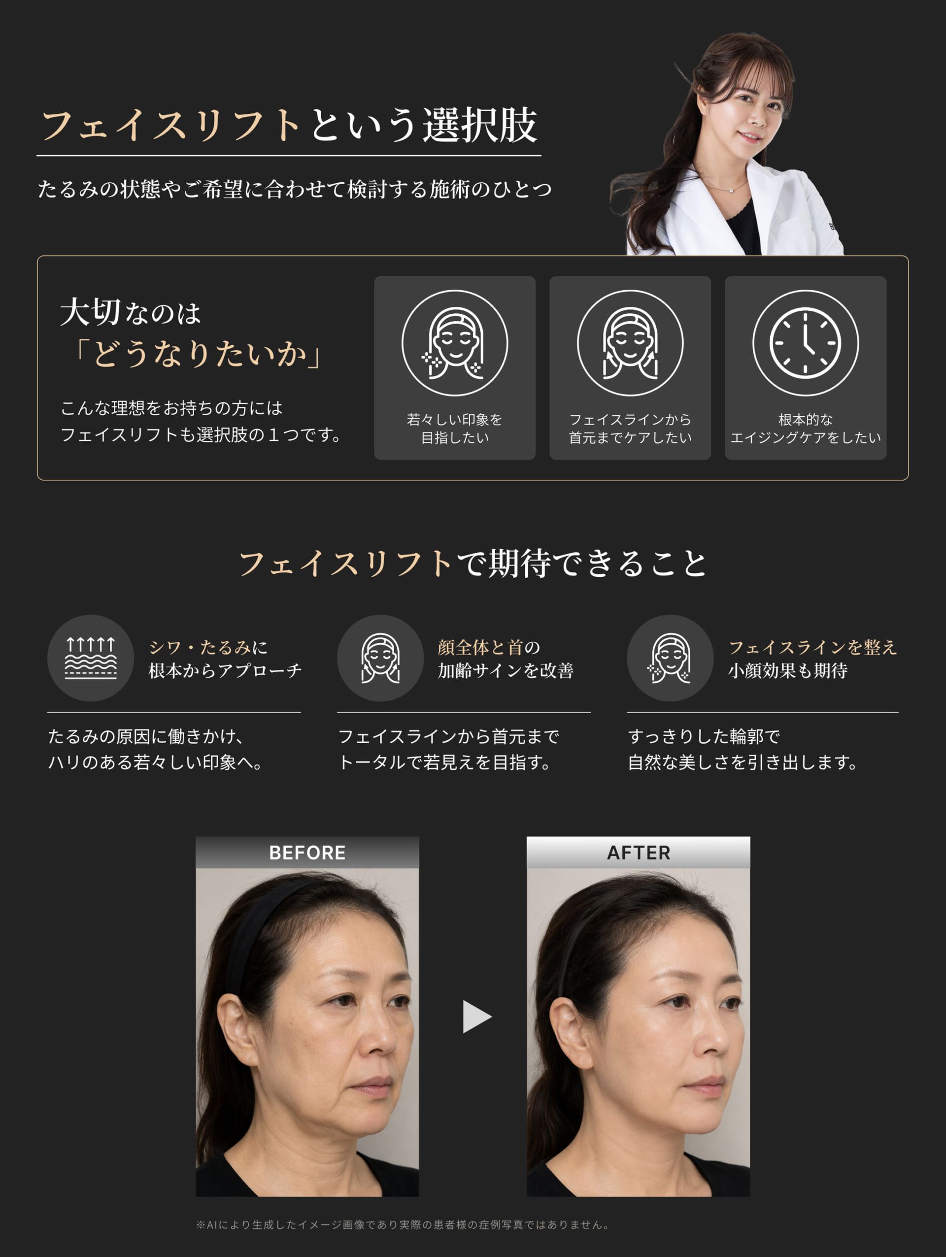 フェイスリフトで期待できることをまとめた図