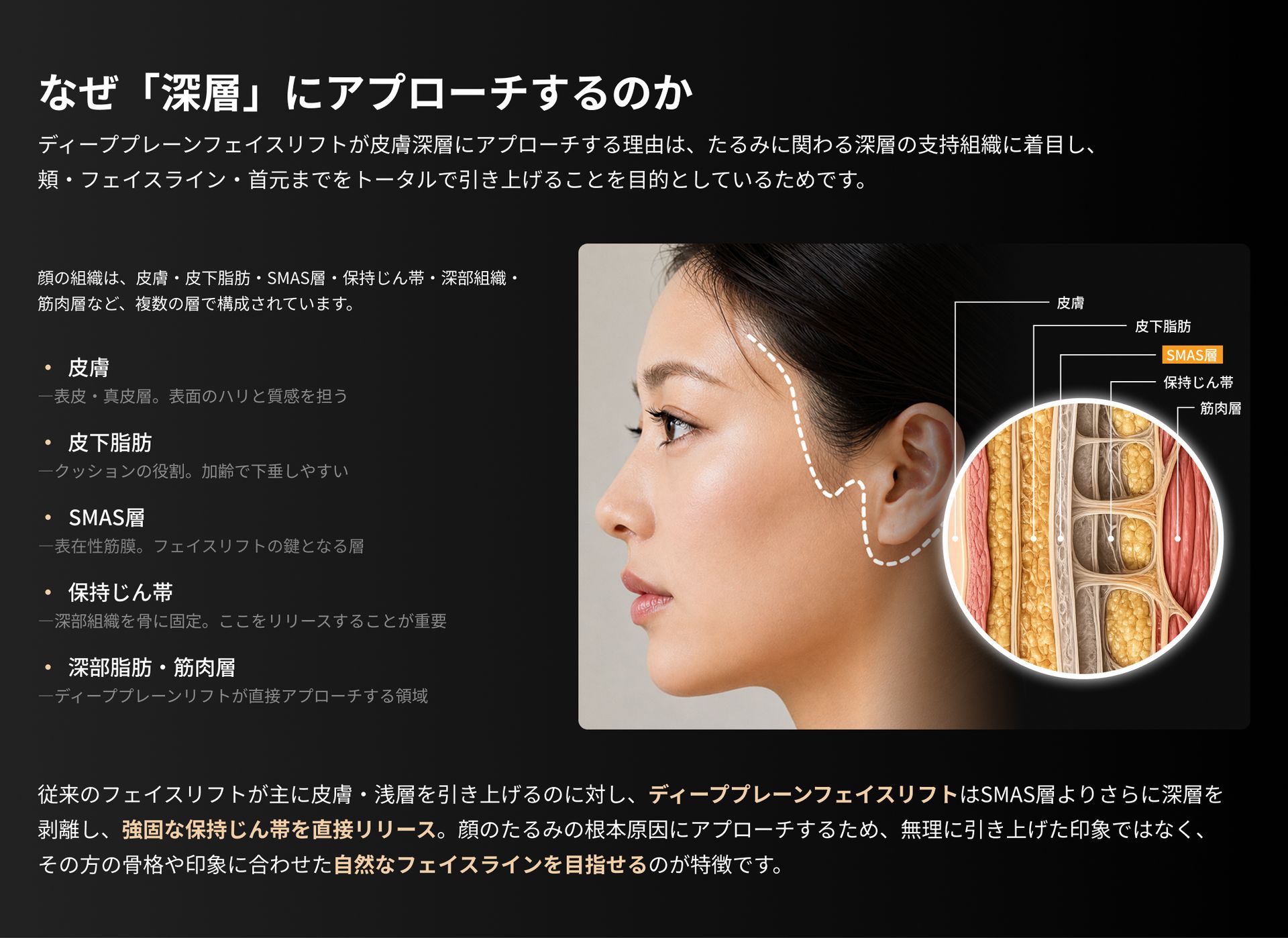 ディーププレーンフェイスリフトの仕組みと特徴を示した図