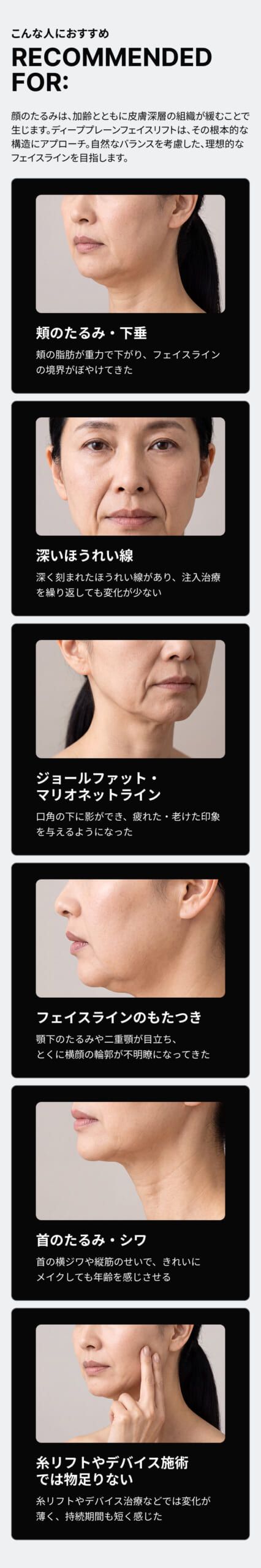 ディーププレーンフェイスリフト｜銀座・表参道にあるBIANCA CLINIC