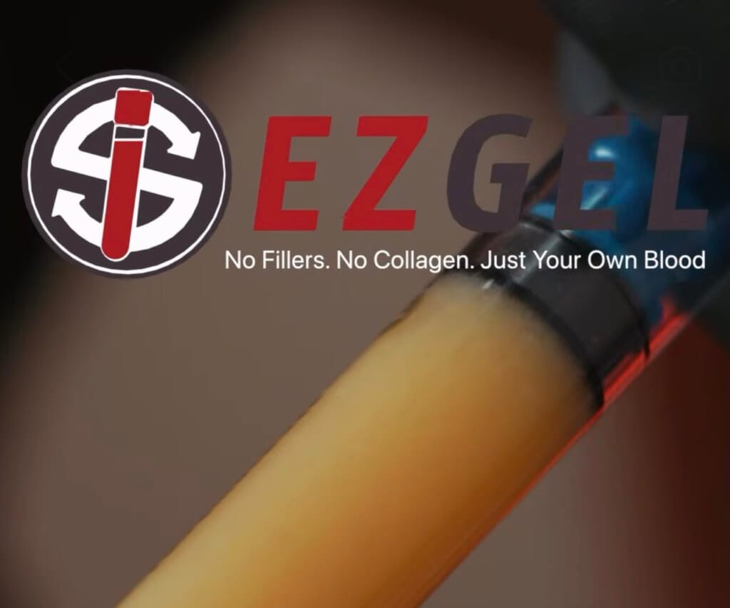 ヒアルロン酸のその先へ～ezGEL（PRF）～