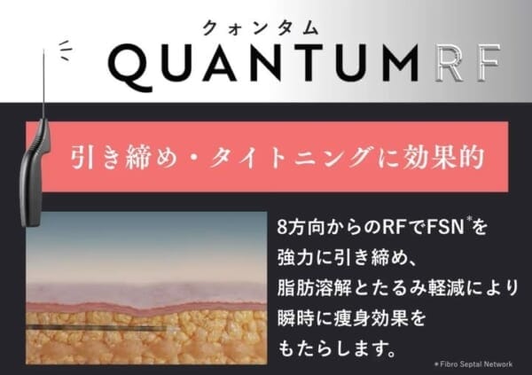 クォンタムの機械の特徴を説明する画像