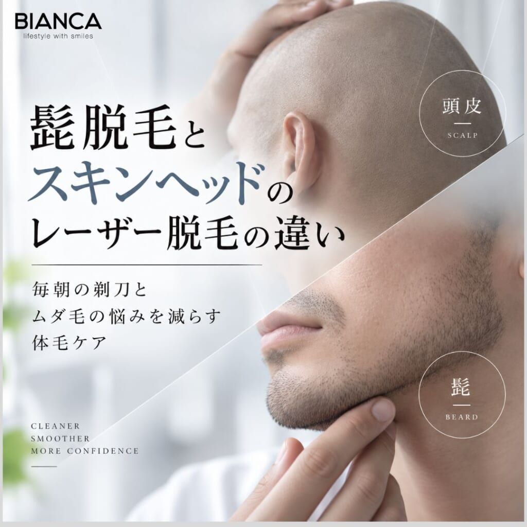 髭脱毛とスキンヘッドのレーザー脱毛の違い｜毎朝の剃刀とムダ毛の悩みを減らす体毛ケア