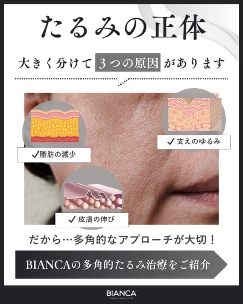 たるみの原因３つと多角的なアプローチが必要ということを説明する画像