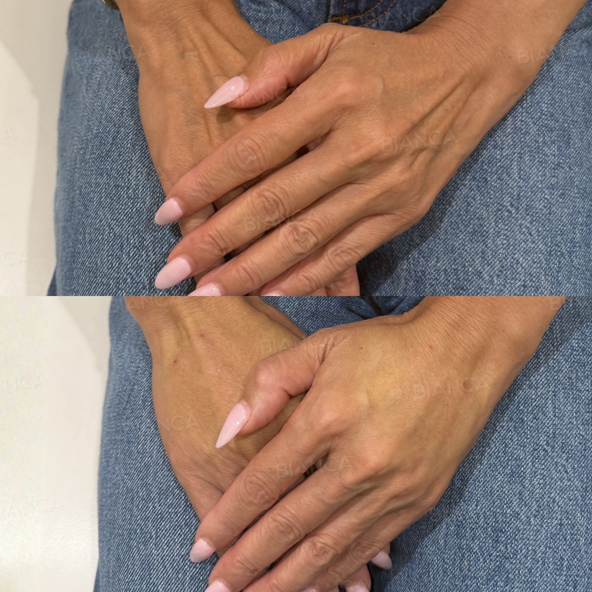 GOURI(手の甲)