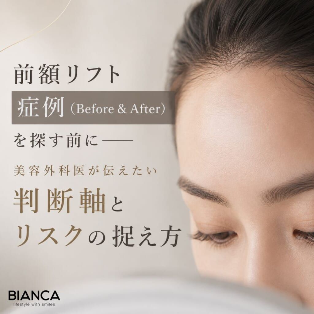前額リフト 症例（Before & After）を探す前に――美容外科医が伝えたい判断軸とリスクの捉え方