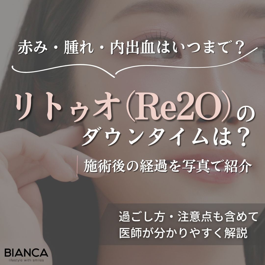 リトゥオのダウンタイムは何日？症状・経過をBIANCA CLINICが解説