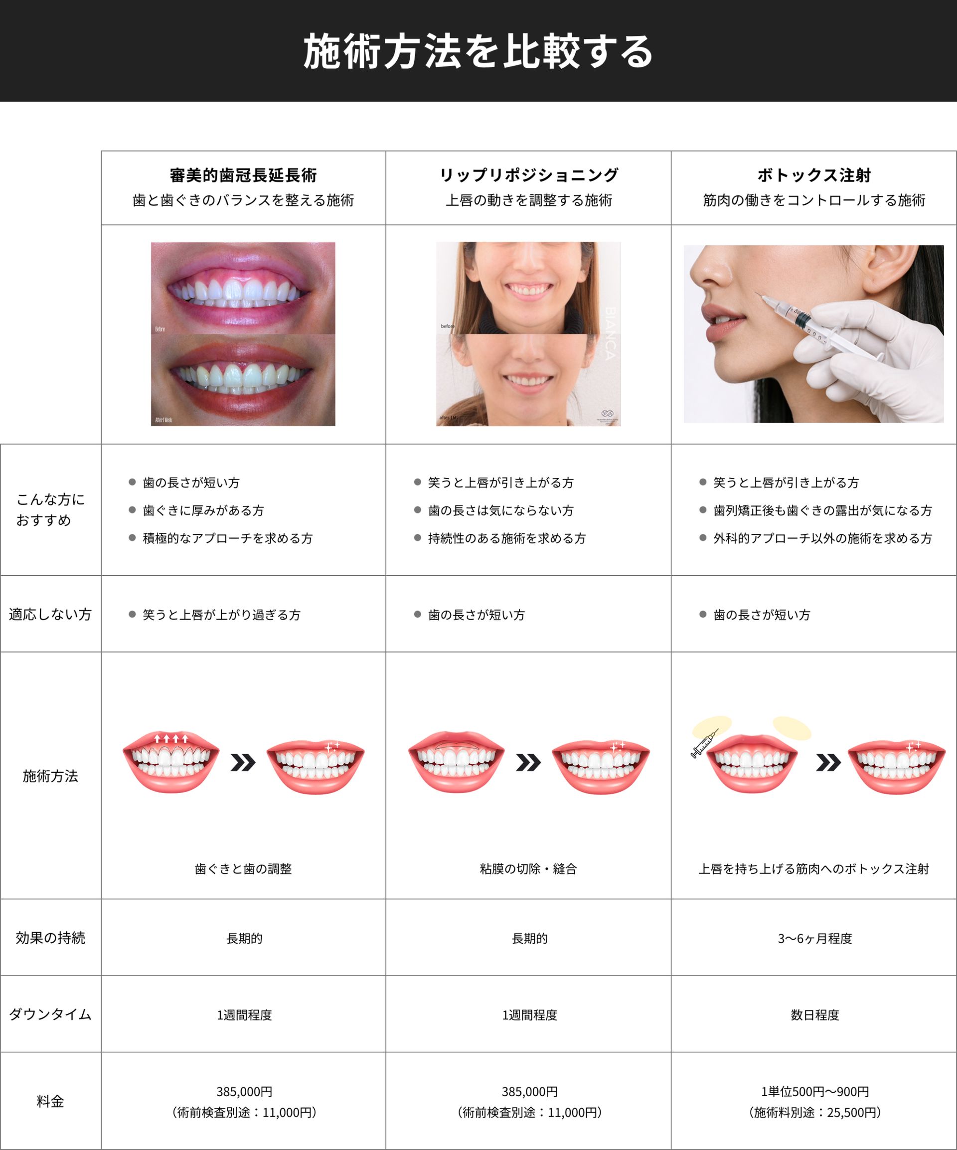 審美歯科の施術方法を比較する