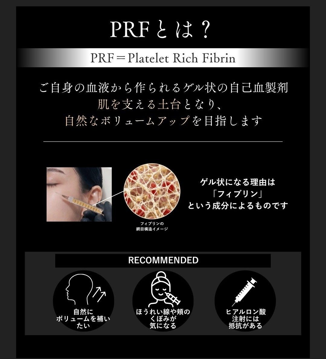 PRFとはを説明した画像