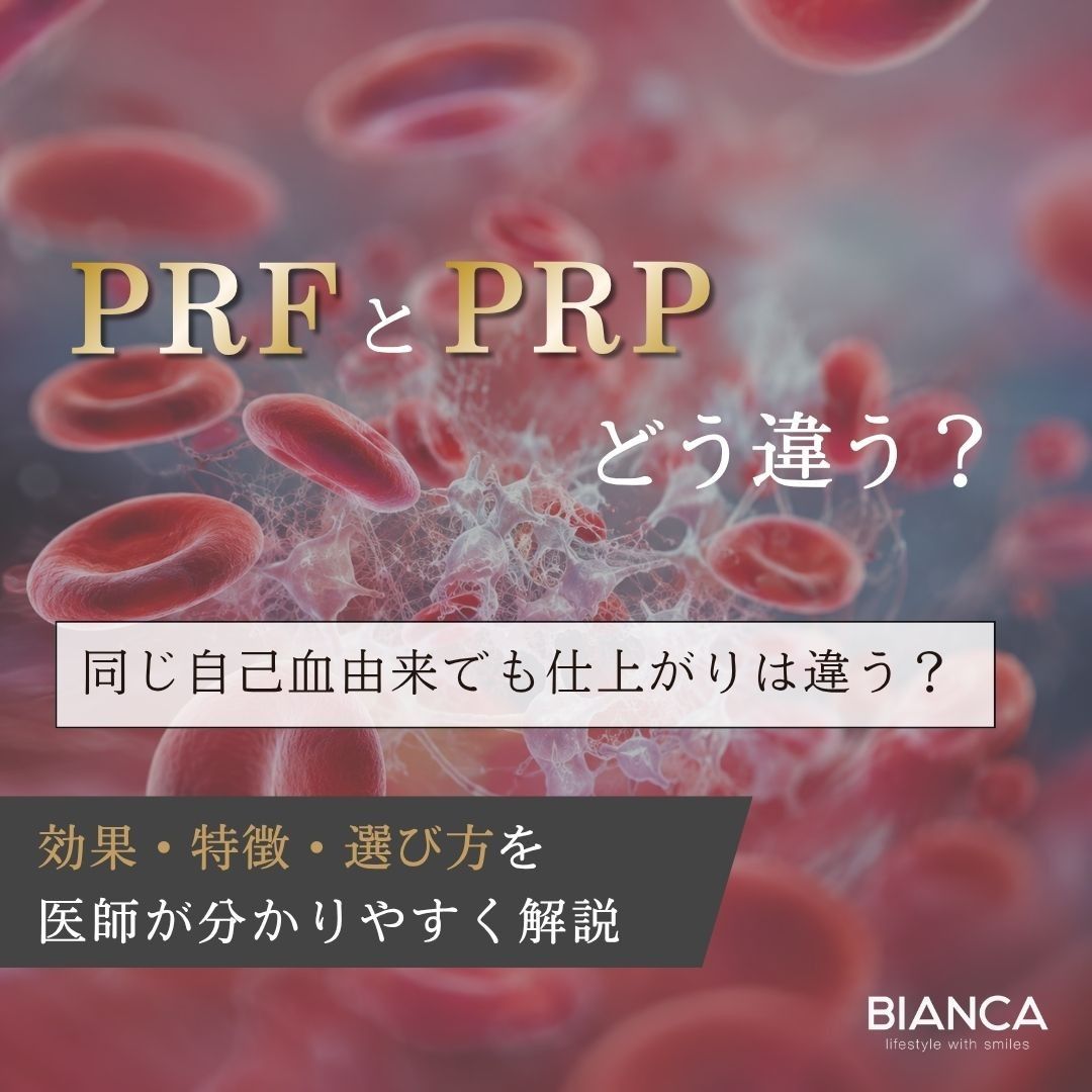 イージーゲル(PRF)とPRP注入の違いは?効果や選び方を医師が解説するアイキャッチ画像