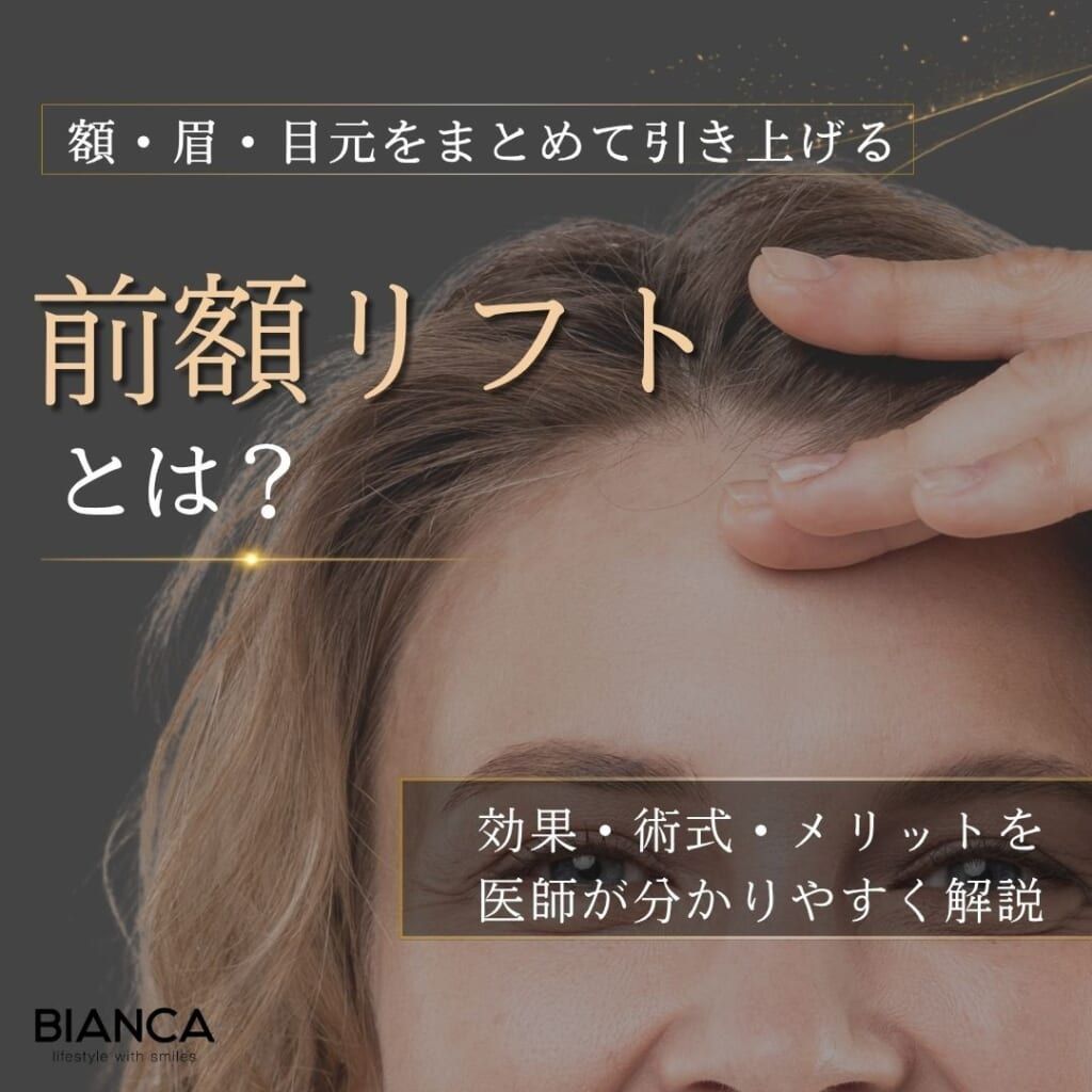 前額リフトとは？仕組みと効果、メリット・デメリットを解説