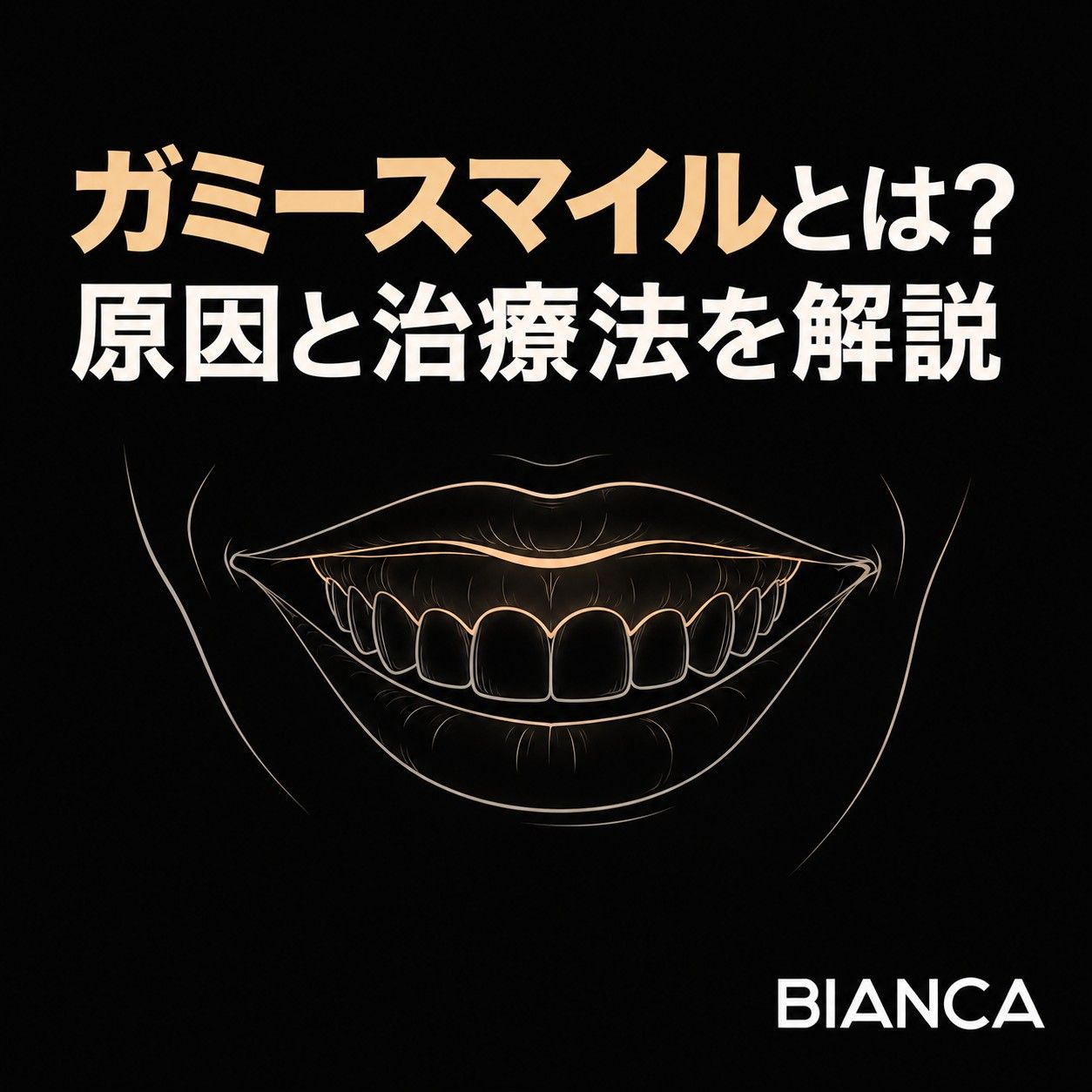 ガミースマイルとは？原因や特徴、治療法を歯科医師が解説するアイキャッチ画像