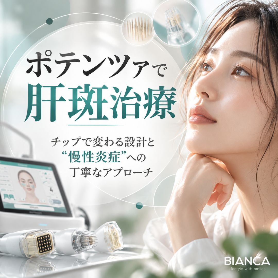 ポテンツァ 肝斑治療｜チップで変わる設計と“慢性炎症”への丁寧なアプローチ