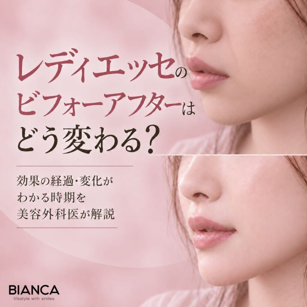 レディエッセのビフォーアフターはどう変わる？まず知っておきたい見方