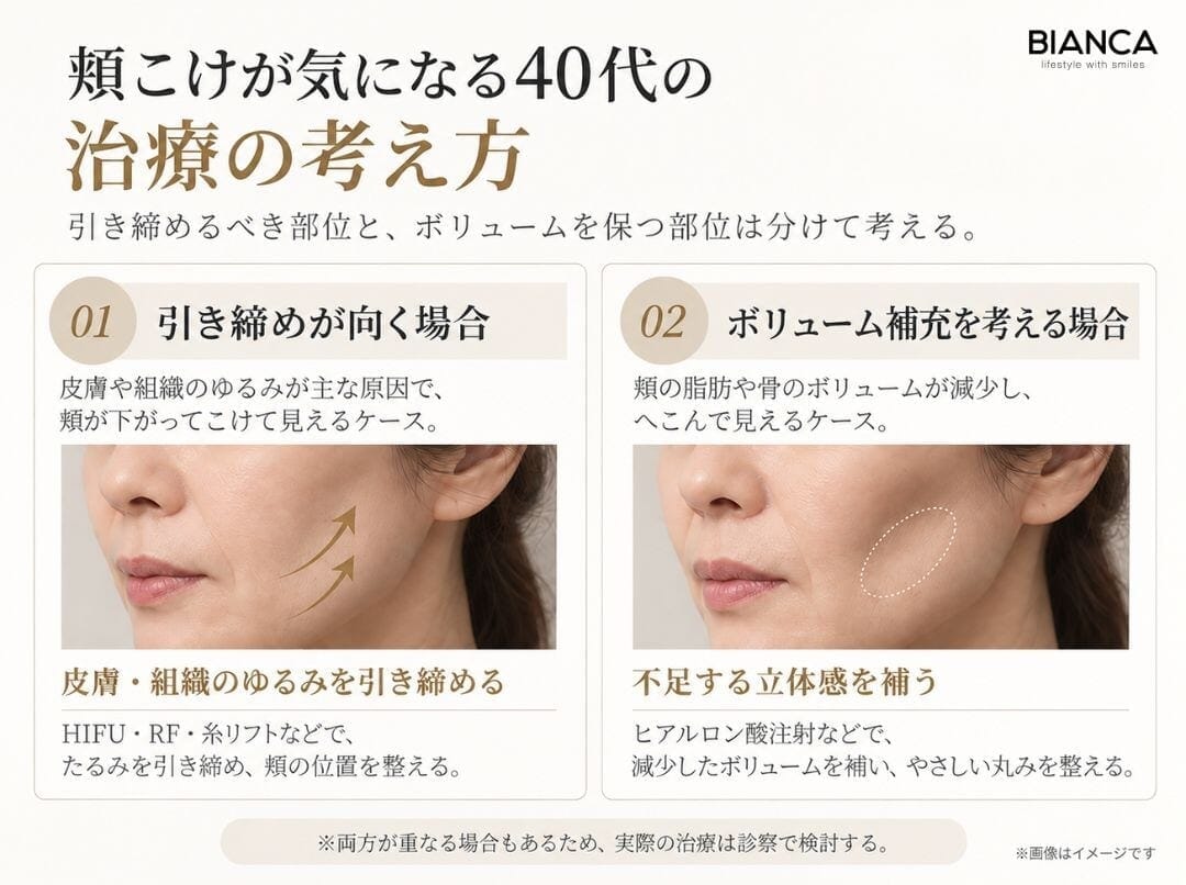 頬こけが気になる40代の治療の考え方を説明する画像
