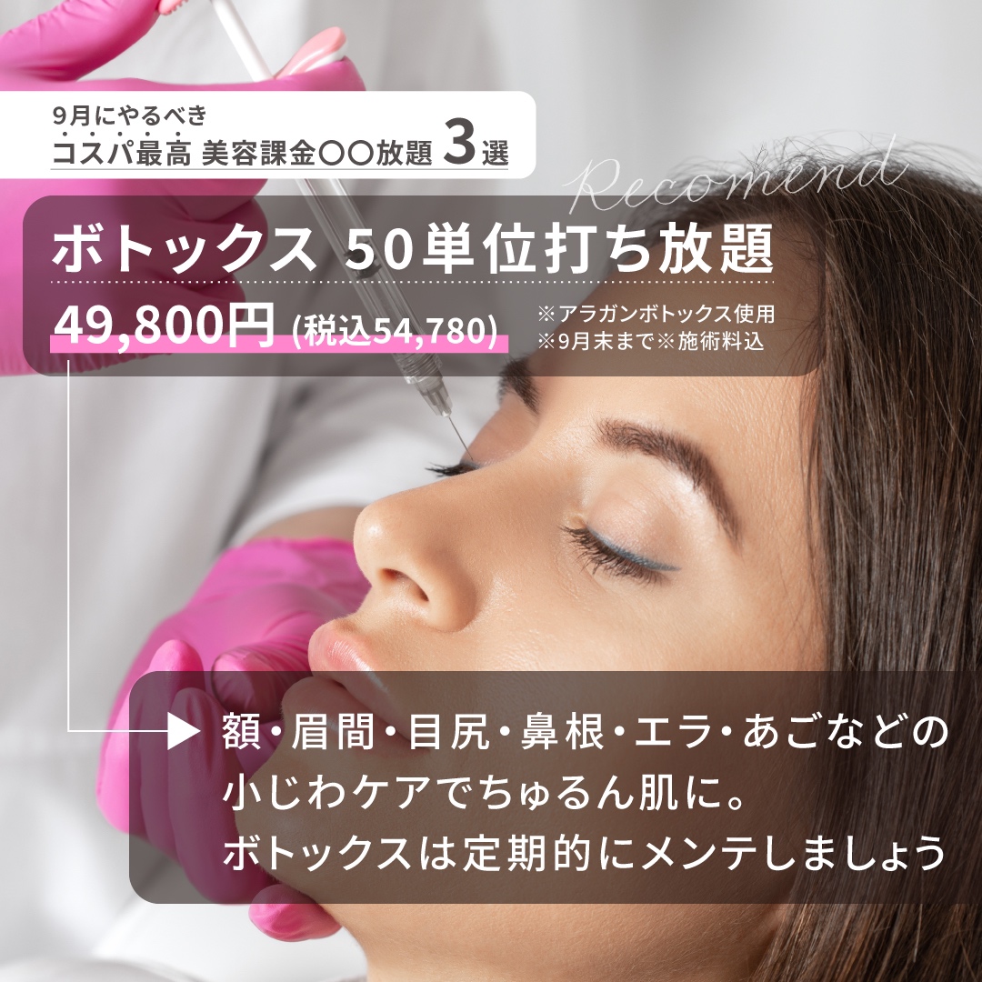 ボトックス50単位打ち放題
