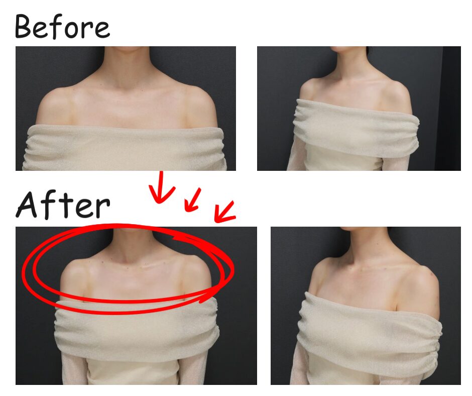 今のトレンドは「直角肩」⁉