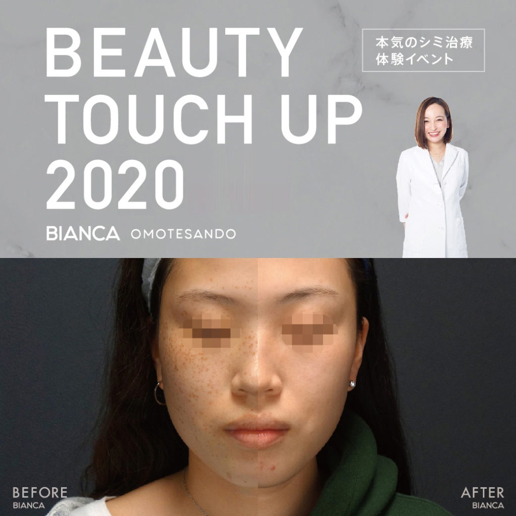 本日はしみのタッチアップを行いました！