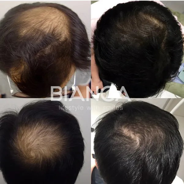 Before / After