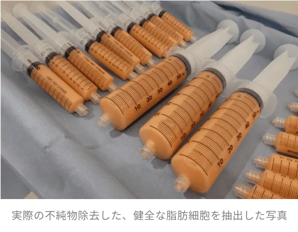 実際の不純物除去した、健全な脂肪細胞を抽出した写真