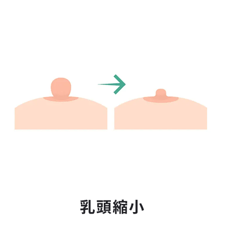 乳頭縮小