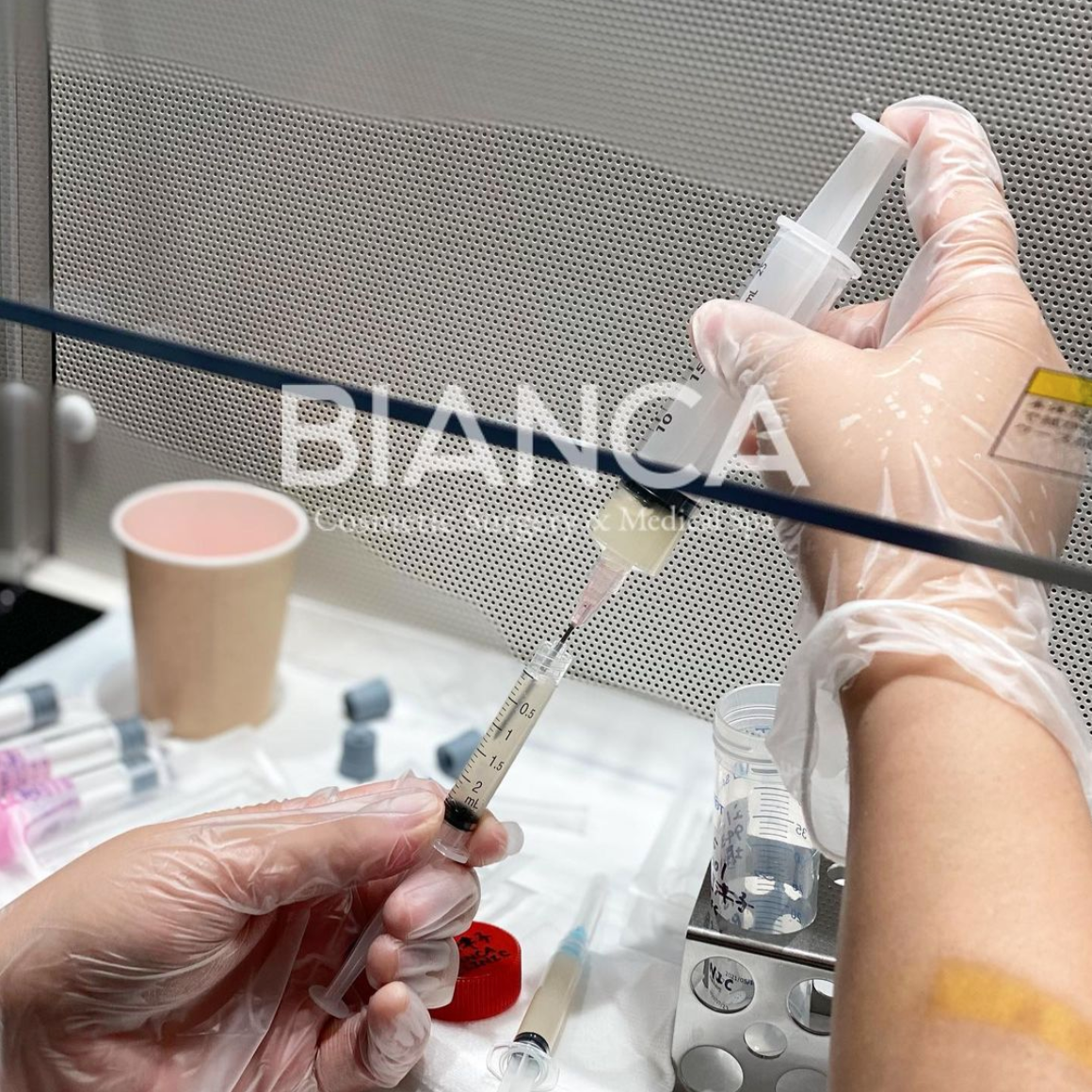 真皮線維芽細胞療法（Fibroblasts） | 日本を代表する美容健康再生医療